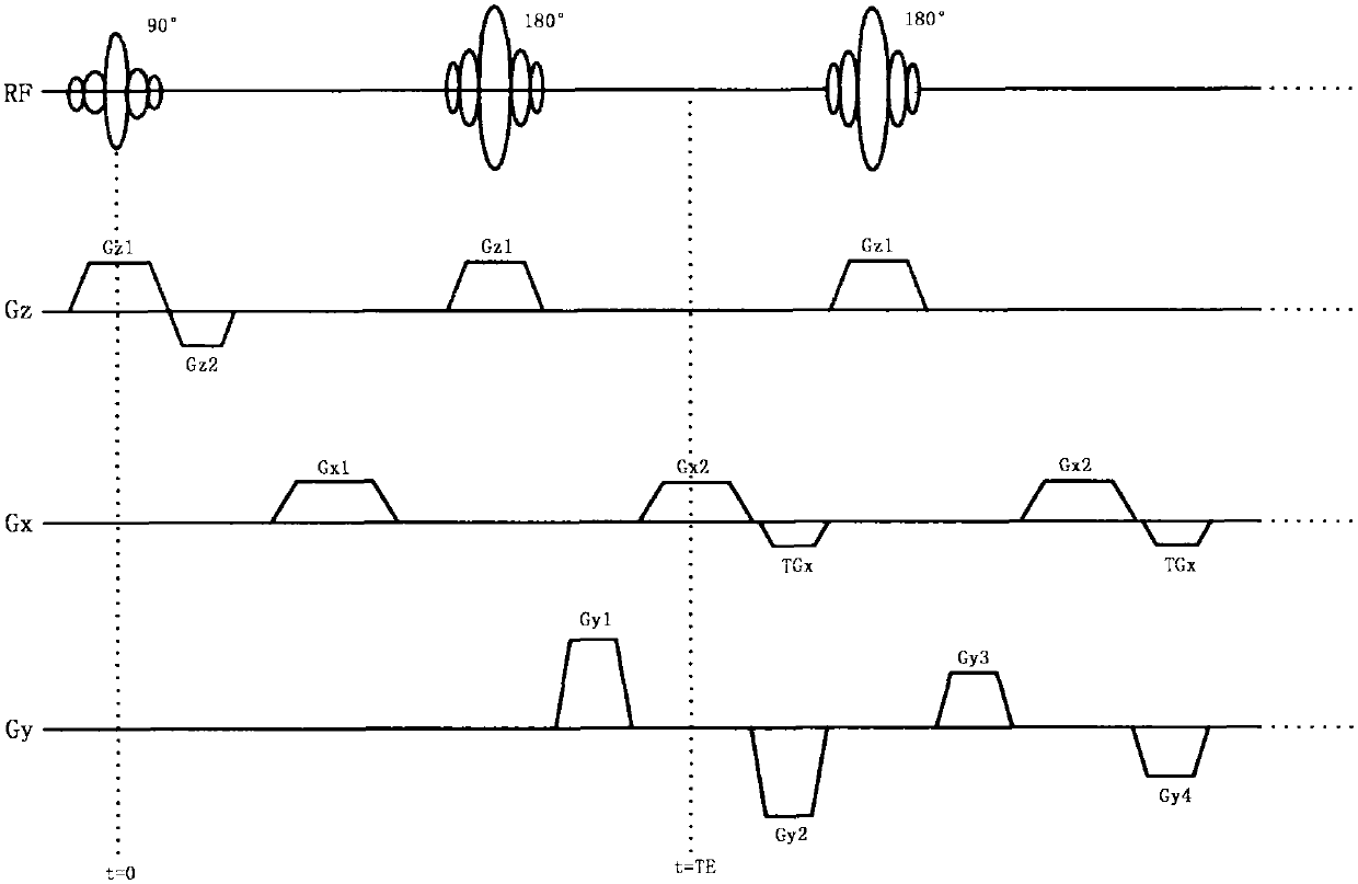 A Flow Compensation Method for Magnetic Resonance Imaging System