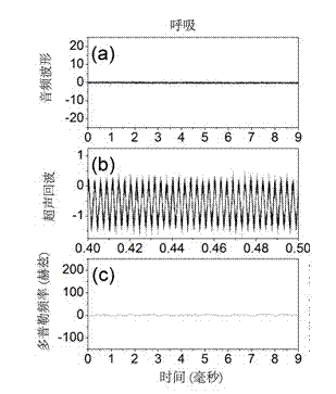 Vocal-cord vibration nondestructive measurement method utilizing natural sound track ultraphonic waveguide effect