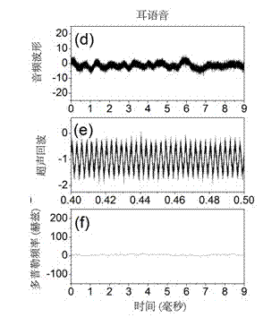 Vocal-cord vibration nondestructive measurement method utilizing natural sound track ultraphonic waveguide effect