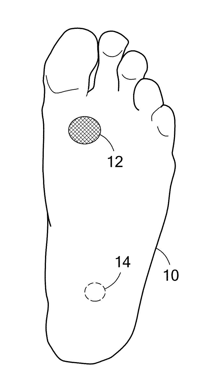 Apparatus for measuring temperature distribution across the sole of the foot