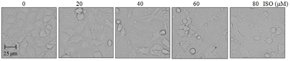 Application of isorhapontigenin (ISO) to preparation of drugs with antitumor activity