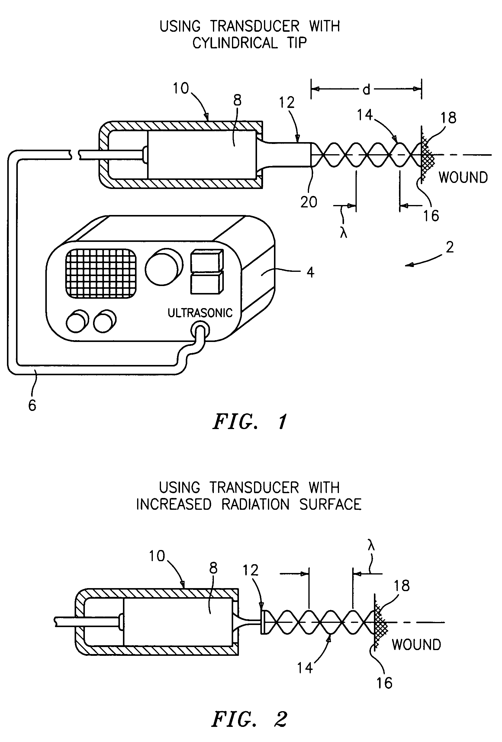 Ultrasound wound treatment method and device using standing waves