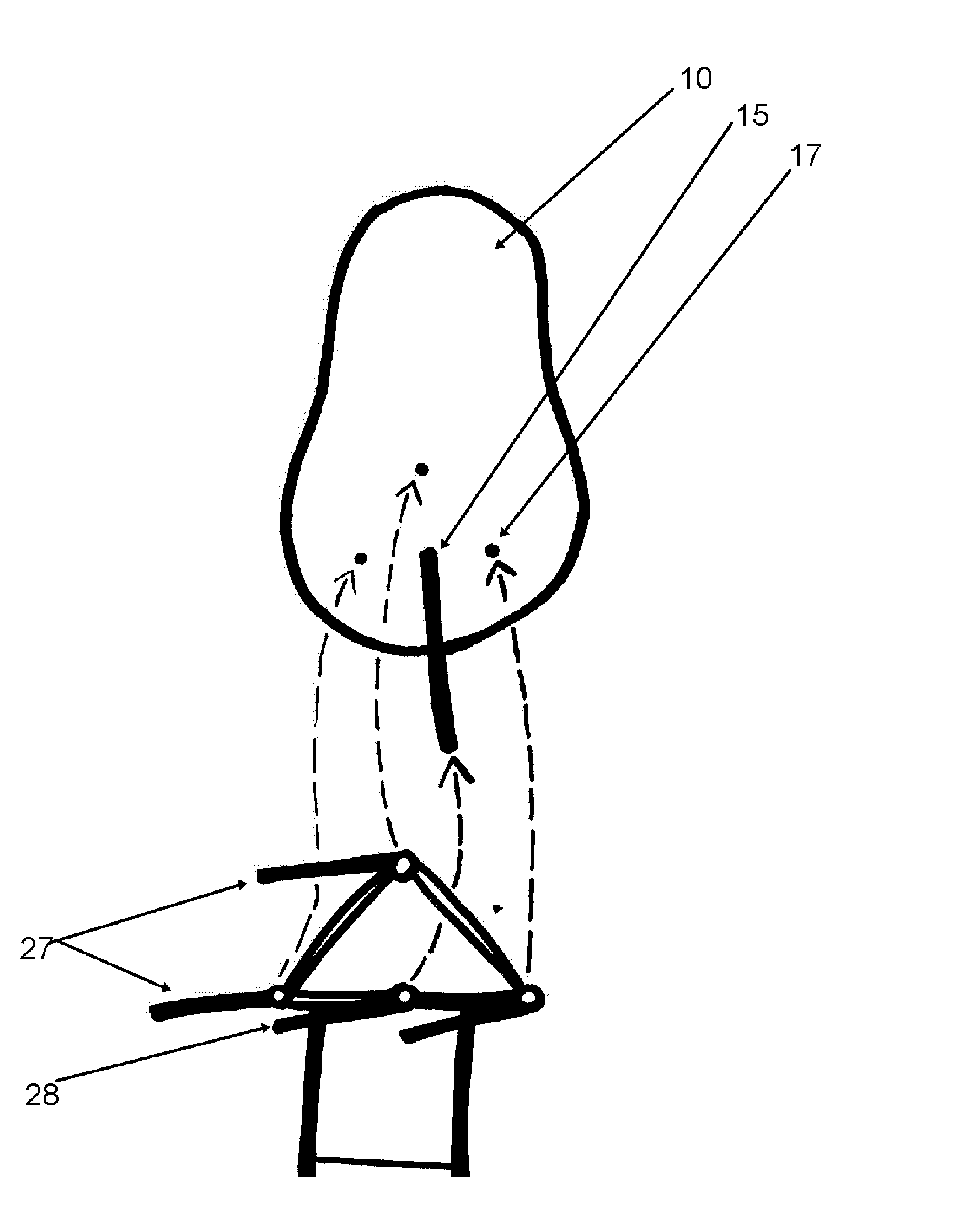 Method for Attachment of Artificial Nail