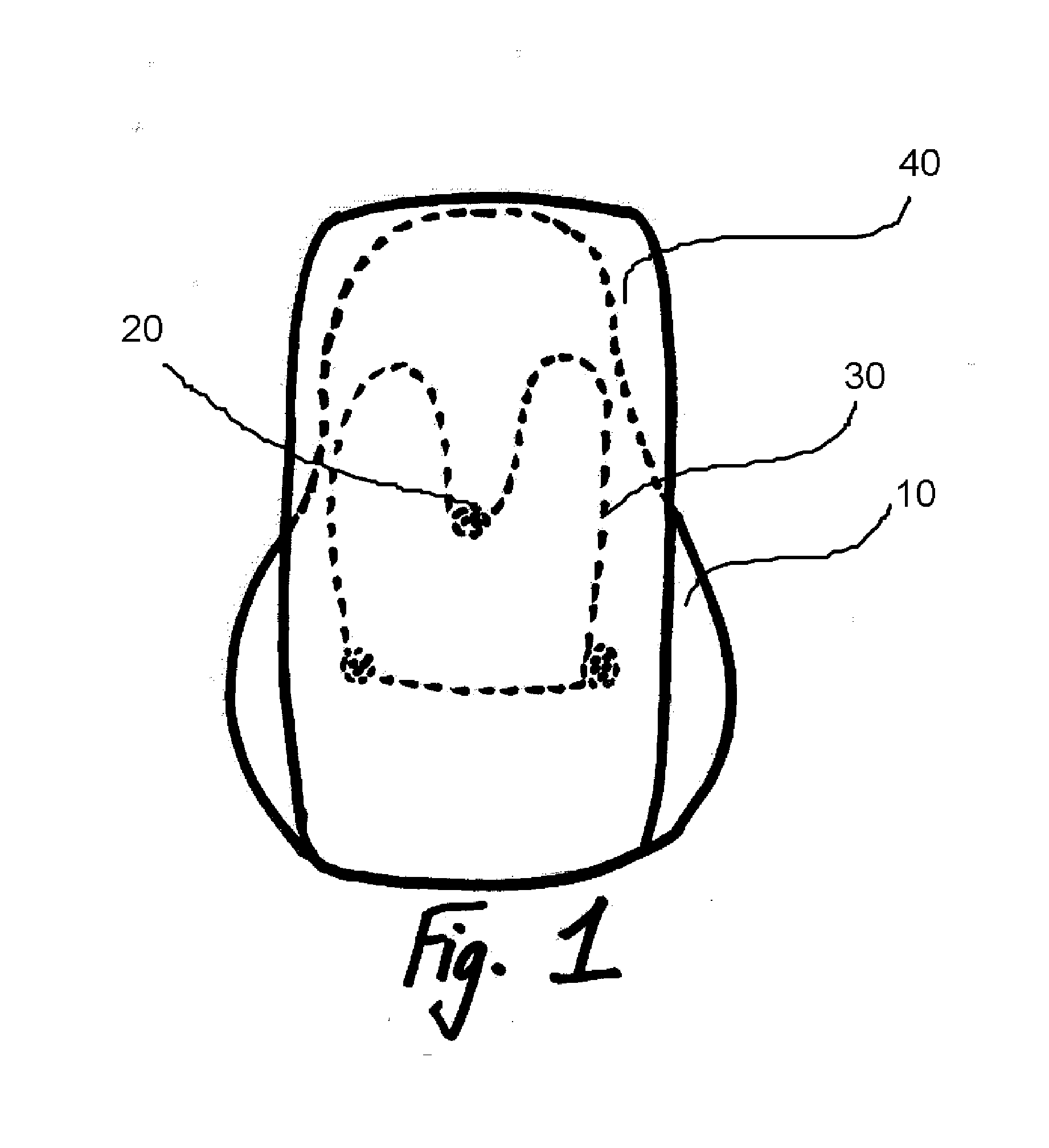 Method for Attachment of Artificial Nail