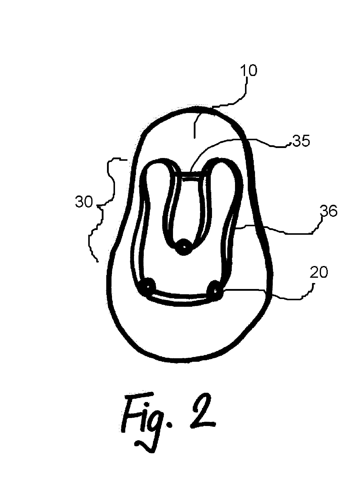 Method for Attachment of Artificial Nail