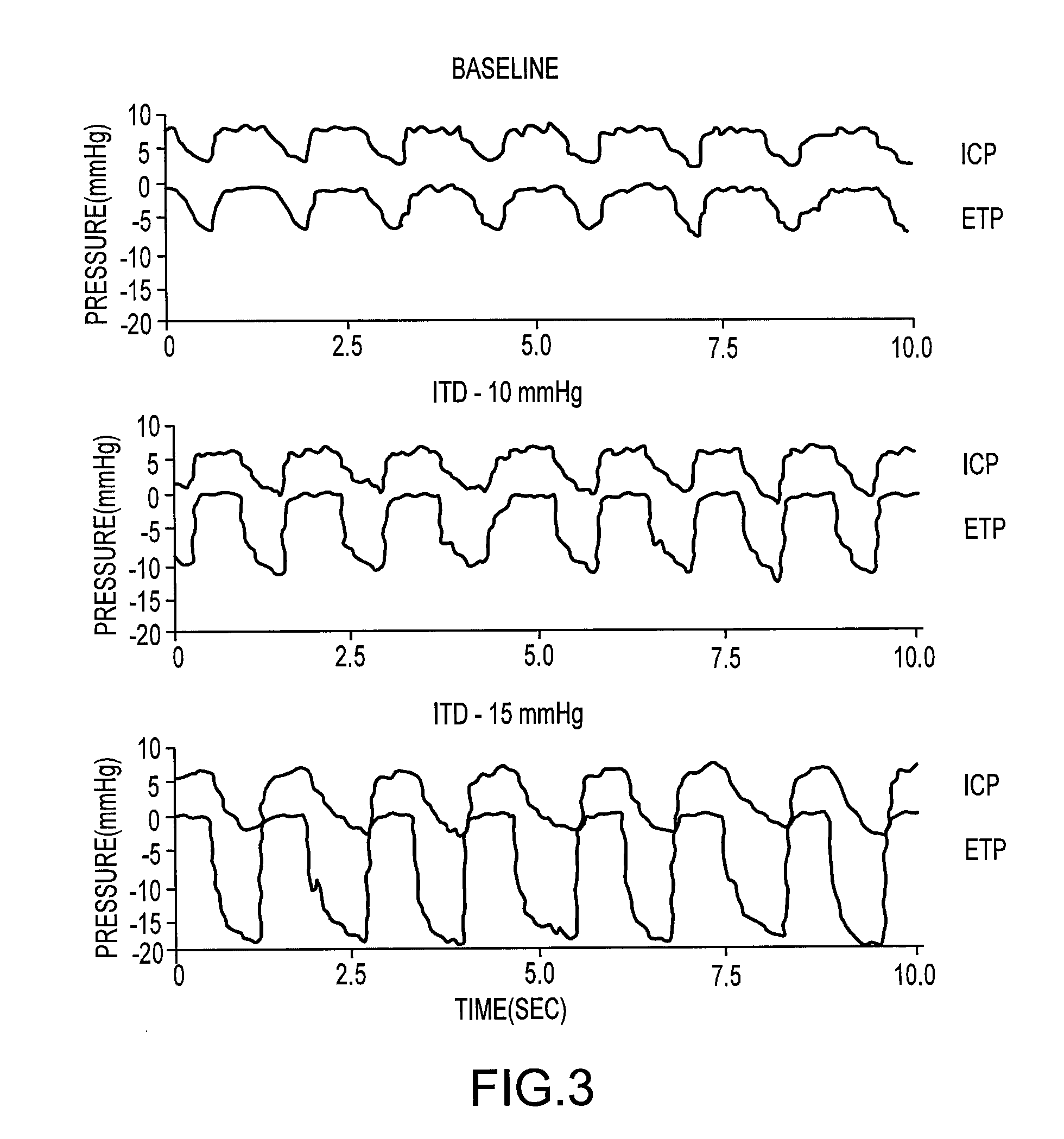 Intrathoracic pressure limiter and cpr device for reducing intracranial pressure and methods of use