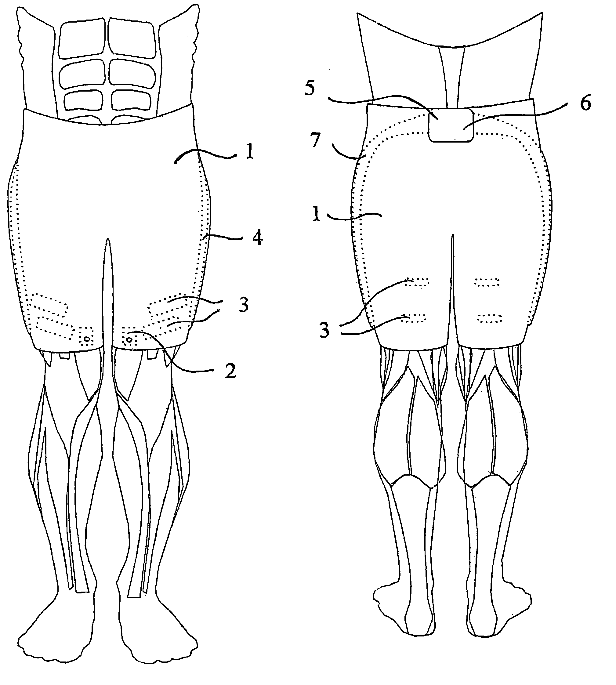 Method and outfit for measuring of action of muscles of body