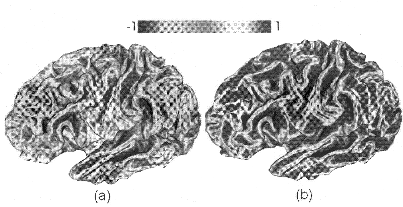 Brain cortex surface maximum principal direction field diffusion method for three-dimensional brain magnetic resonance image