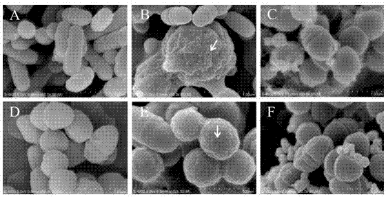 Anti-oral cariogenic bacteria polypeptide Pm1 and preparation method