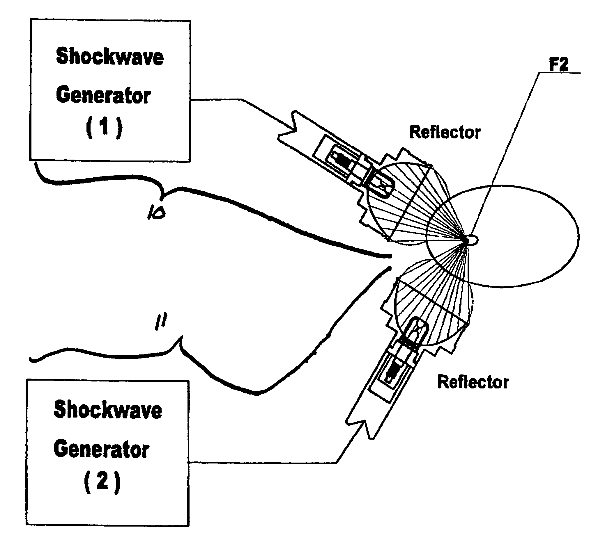 Multiple shockwave focal treatment apparatus with targeting positioning and locating apparatus