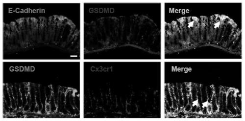 Application of GSDMD protein and target thereof in preparation of medicines for treating inflammatory bowel diseases