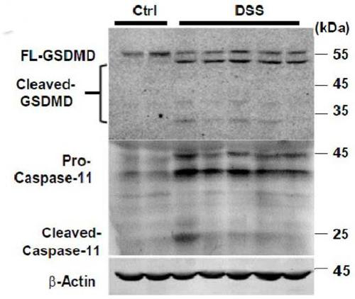 Application of GSDMD protein and target thereof in preparation of medicines for treating inflammatory bowel diseases