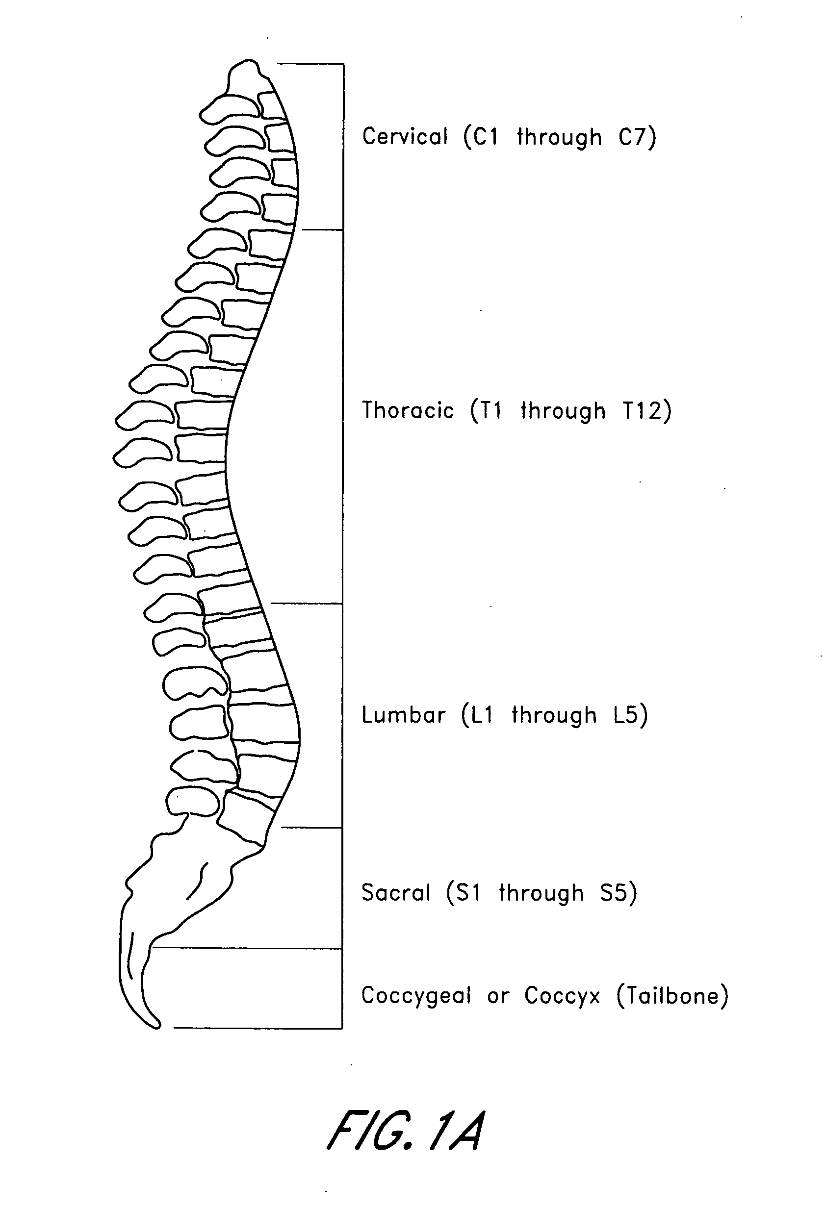 Method and apparatus for manipulating material in the spine