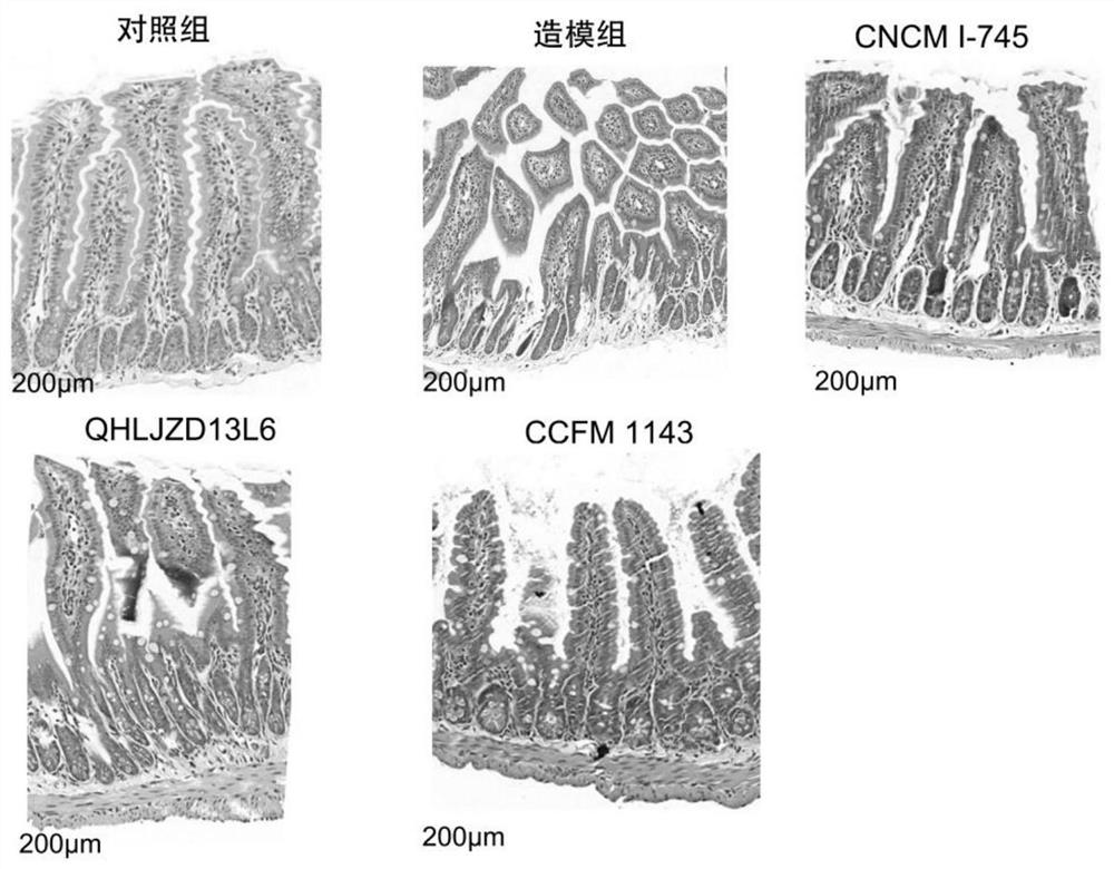 Lactobacillus plantarum capable of relieving diarrhea caused by ETEC and application of lactobacillus plantarum