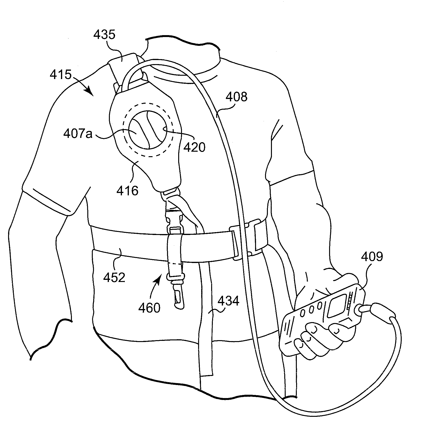Holster for charging pectorally implanted medical devices