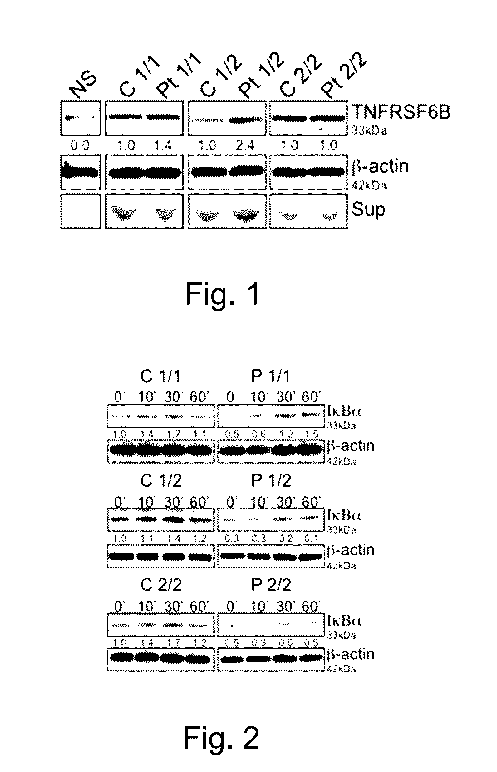 Methods of Treating Autoimmune Conditions in Patients with Genetic Variations in DCR3 or in a DCR3 Network Gene