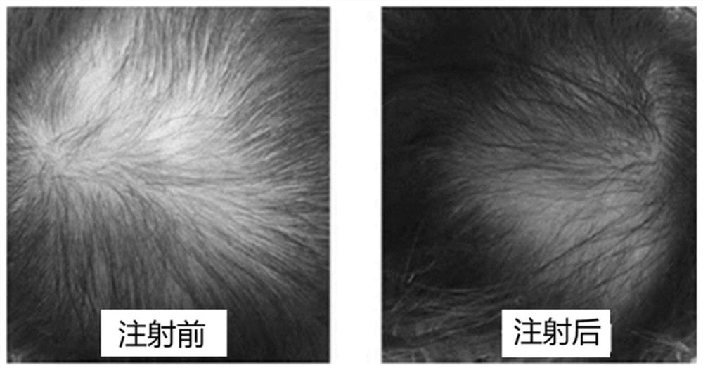 A kind of anti-hair loss repair composition and application