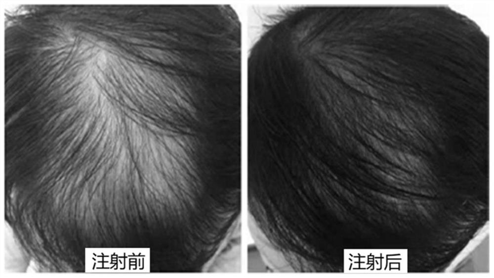 A kind of anti-hair loss repair composition and application