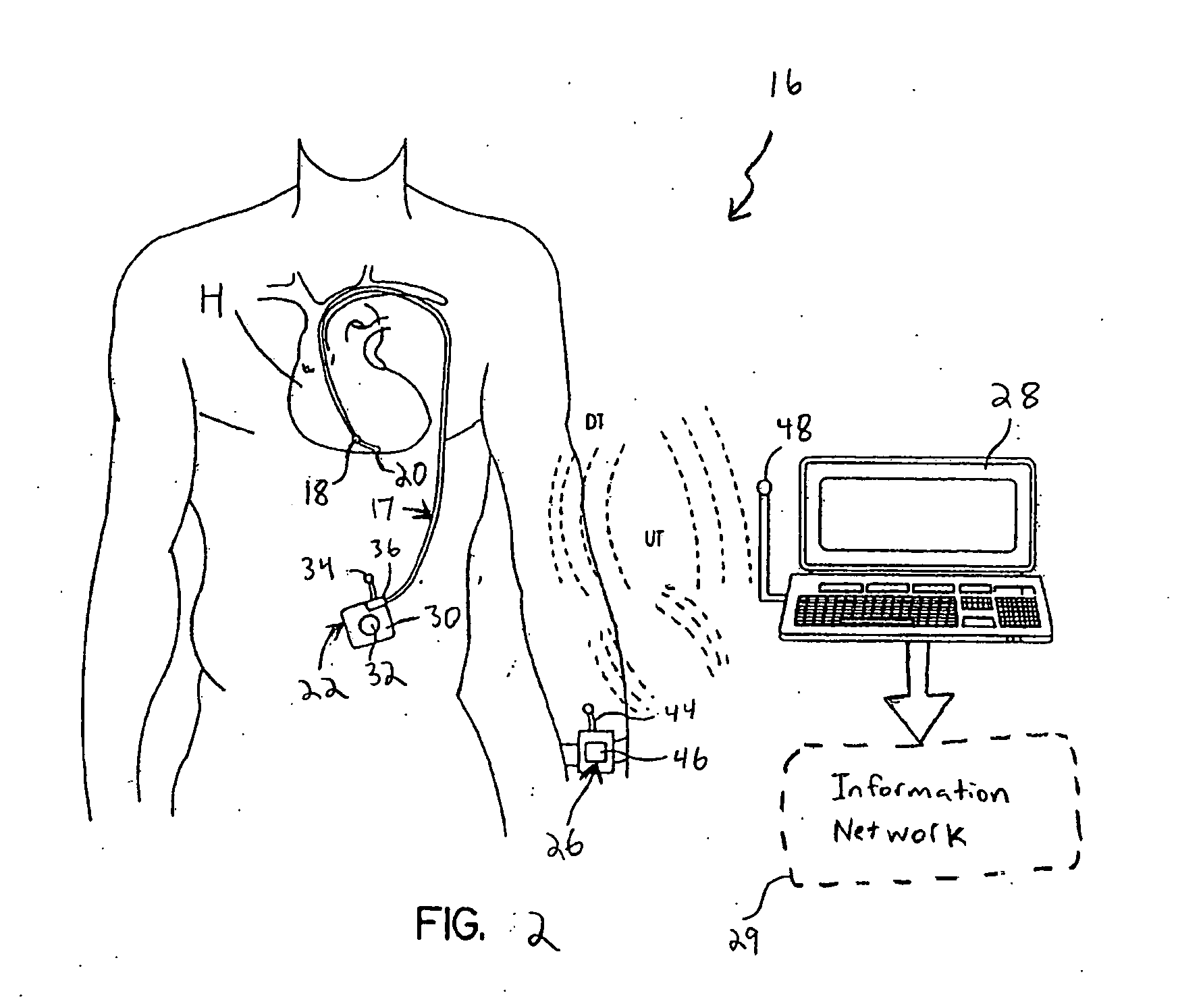 System and method for detecting cardiovascular health conditions using hemodynamic pressure waveforms