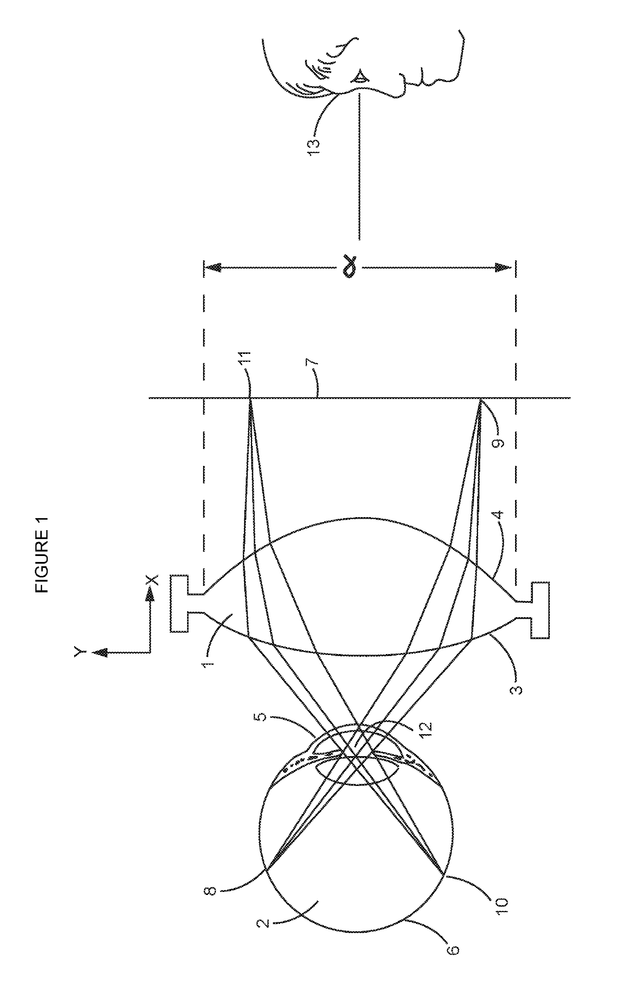 Molded ophthalmic lens with integral ring portion for examination or treatment of an eye