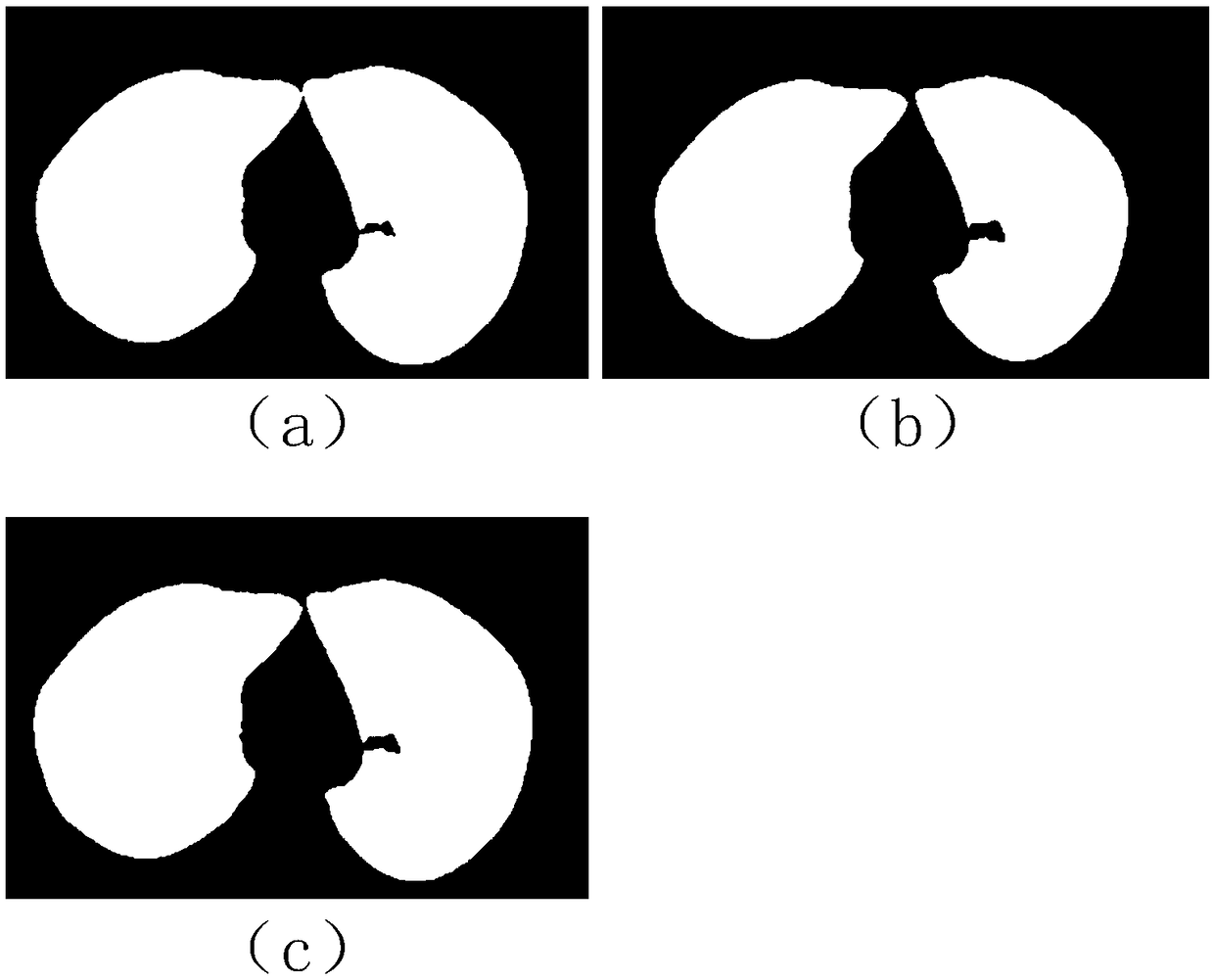 Fully automatic segmentation method for lung parenchyma CT images
