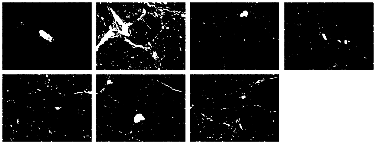 Anti-hepatic fibrosis pharmaceutical composition and application thereof