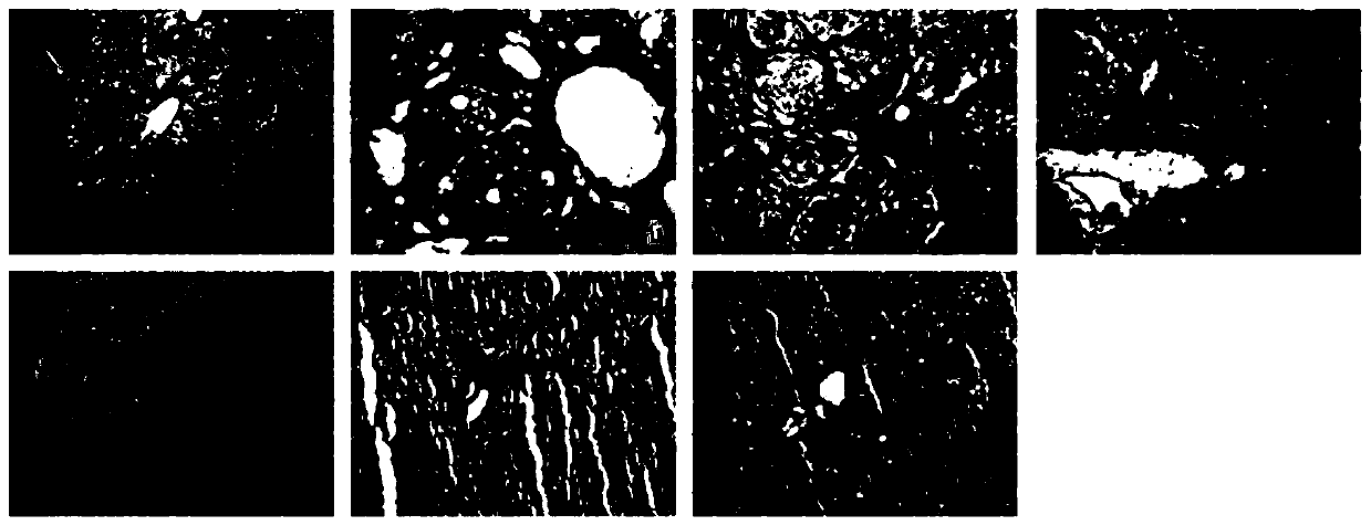 Anti-hepatic fibrosis pharmaceutical composition and application thereof