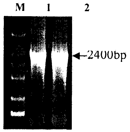 Method for gene cloning of rhodotorula glutinis phenylalanine deaminase and high-efficiency expression method of gene in coliform strain