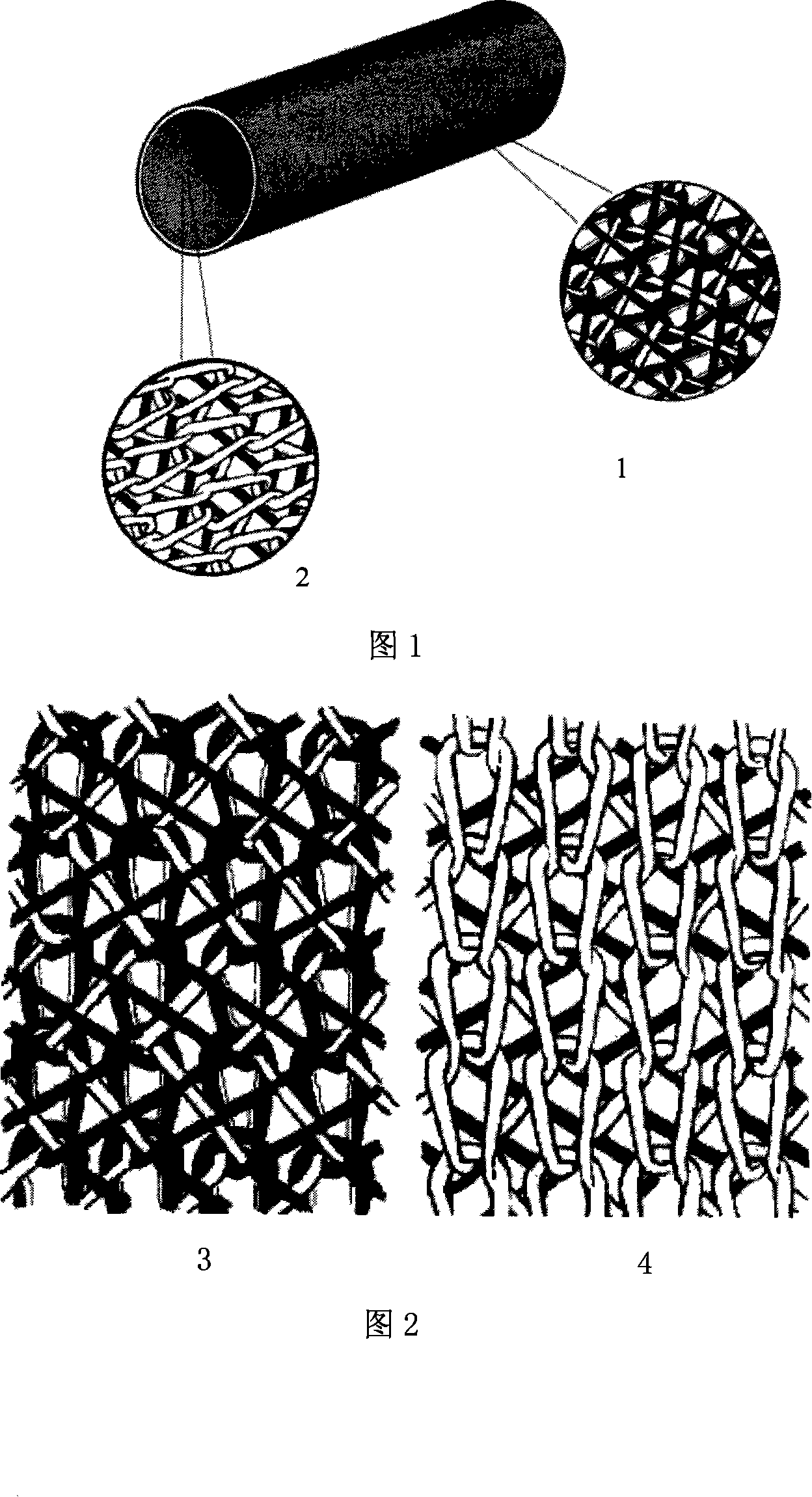 Two-layer warp-knitted tissue textile-type artificial blood vessel