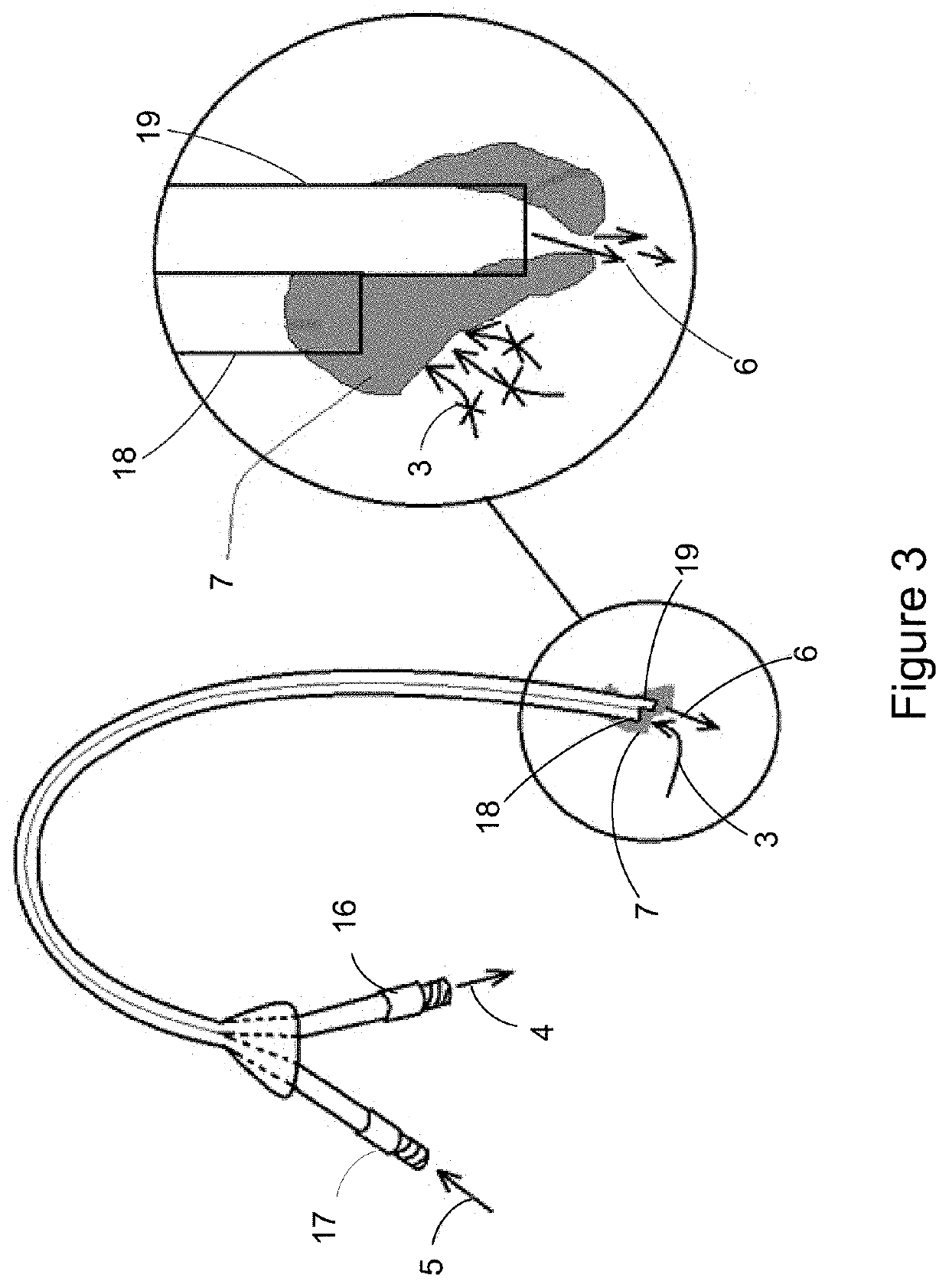 Catheter clearance device and method of use