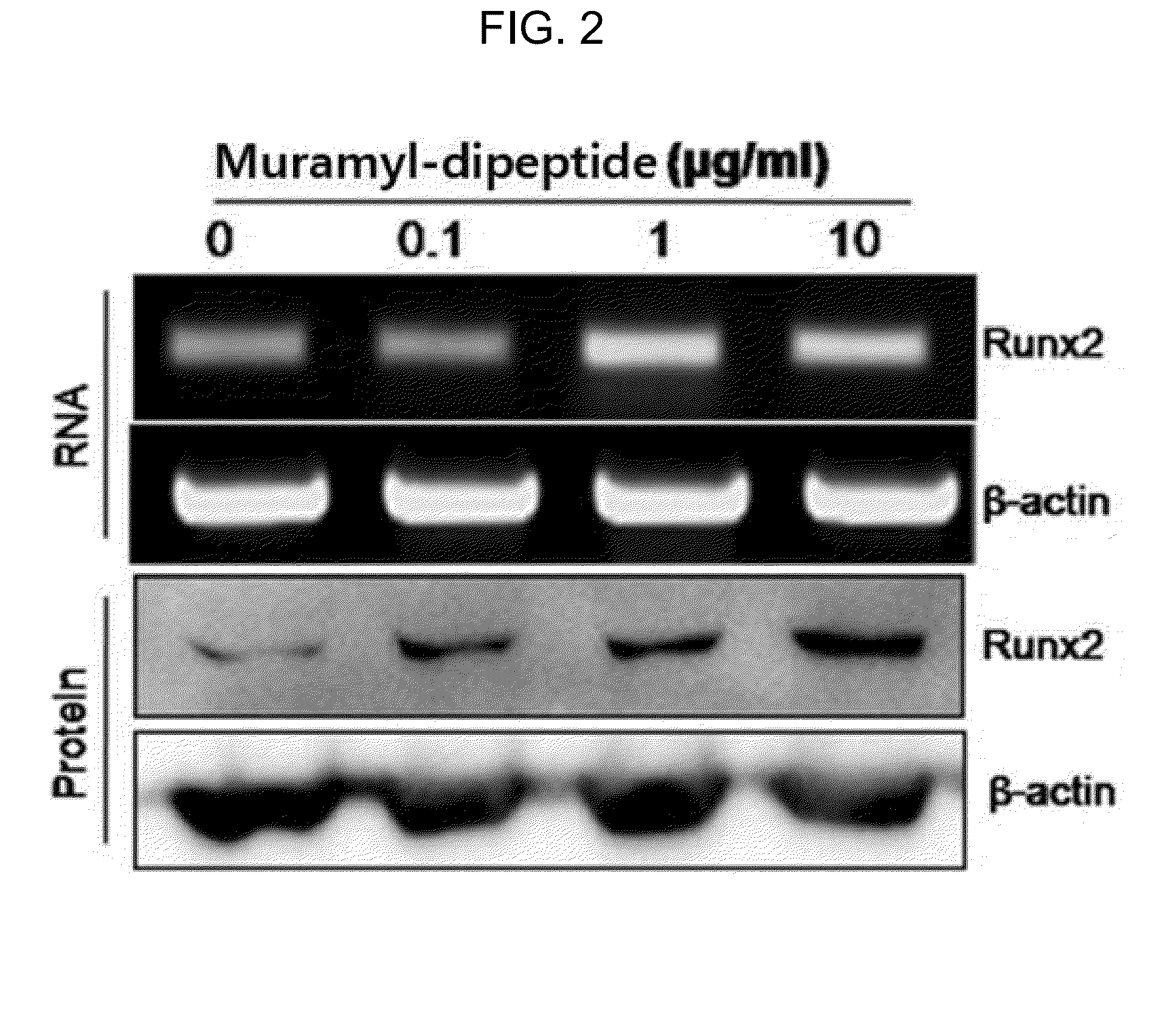 Bone loss preventing and bone regeneration or bone formation promoting pharmaceutical composition comprising muramyl dipeptide