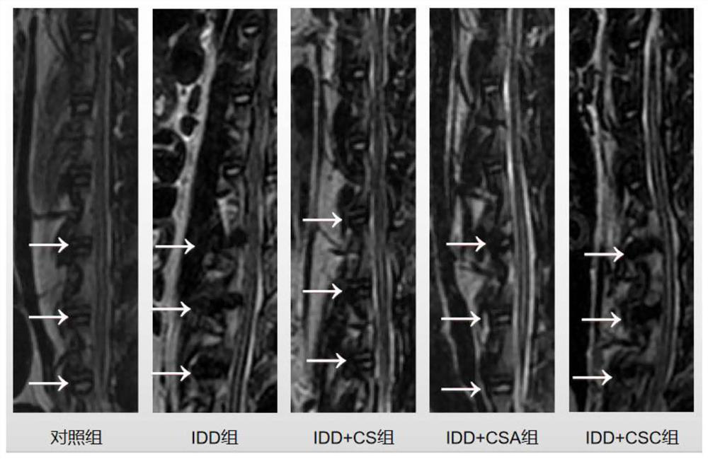 Application of chondroitin sulfate in preparation of medicine for preventing and treating intervertebral disc degeneration