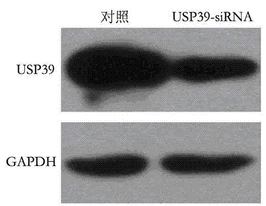Recombinant lentiviral vector containing ubiquitin-specific protease gene USP39-shRNA (short hairpin ribonucleic acid) and application thereof