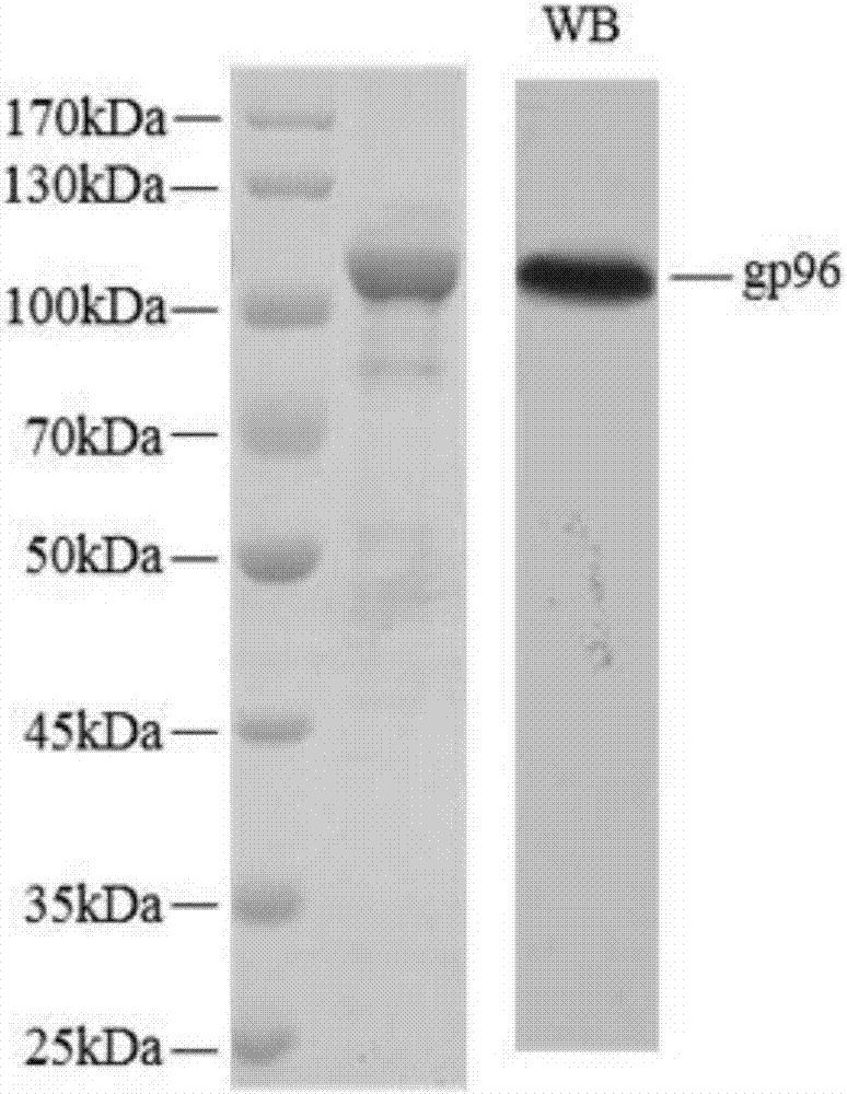 Use of heat shock protein gp96 in treatment on autoimmune hemolytic anemia