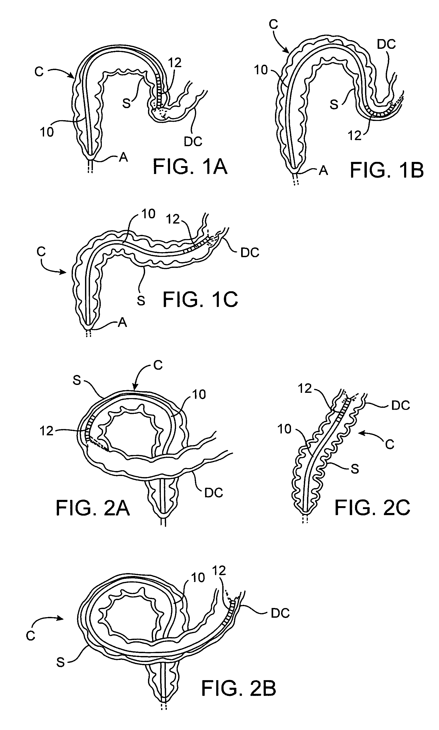 Apparatus and methods for achieving endoluminal access