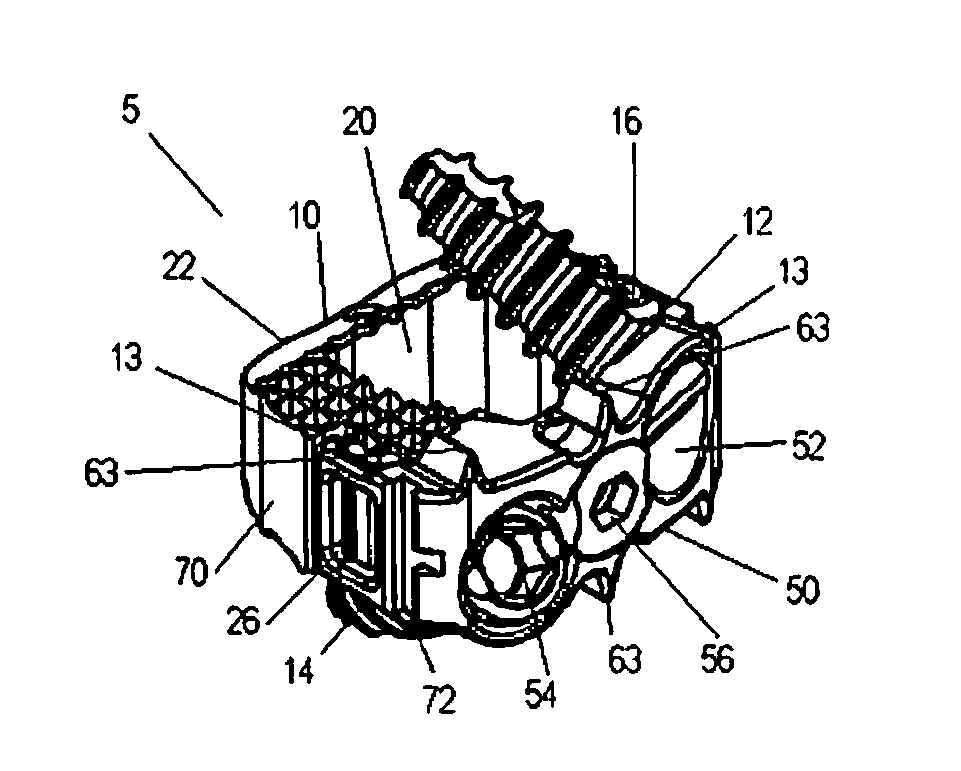 Low Profile Plate