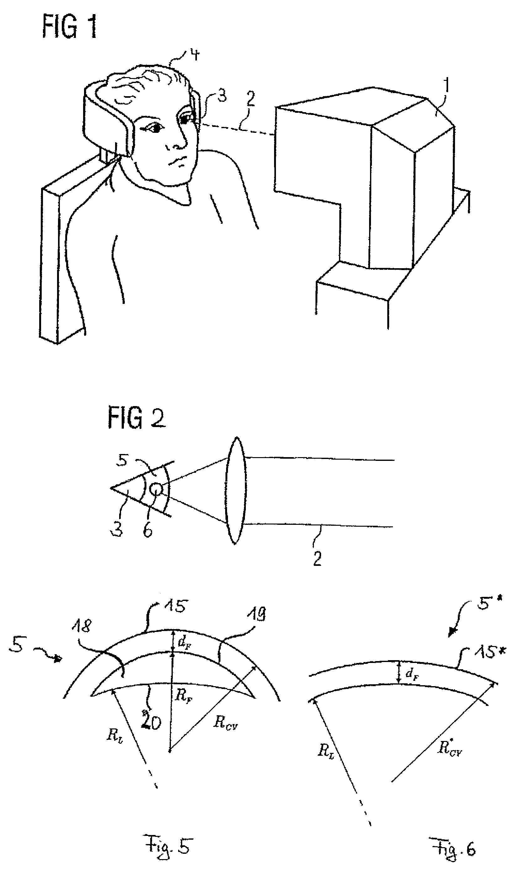 Treatment apparatus for surgical correction of defective eyesight, method of generating control data therefore, and method for surgical correction of defective eyesight