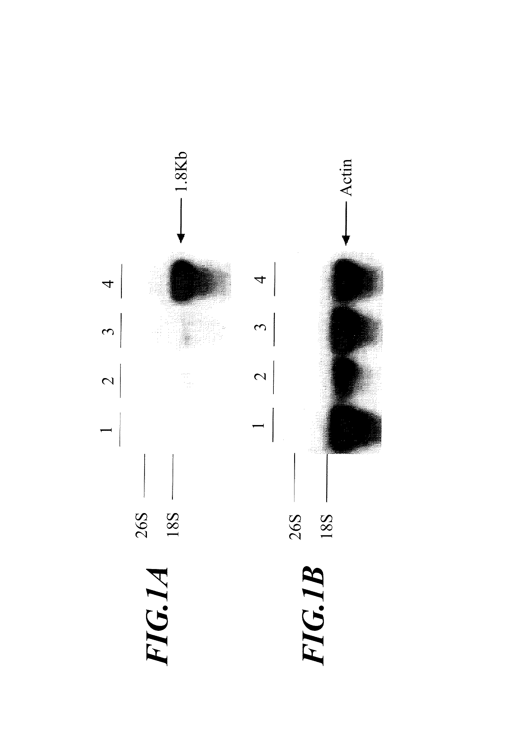 Anther-specific expression promoter in plant and application thereof