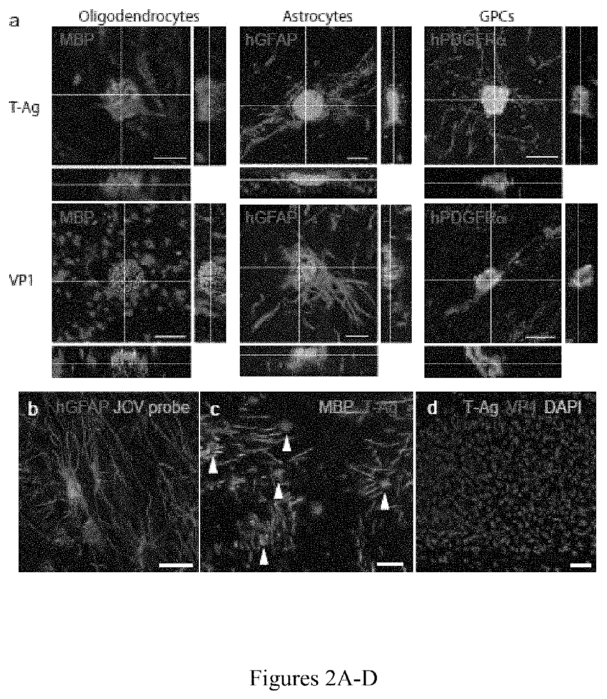 Human glial chimeric model for drug candidate assessment in human gliotrophic viral infections and progressive multifocal encephalopathy