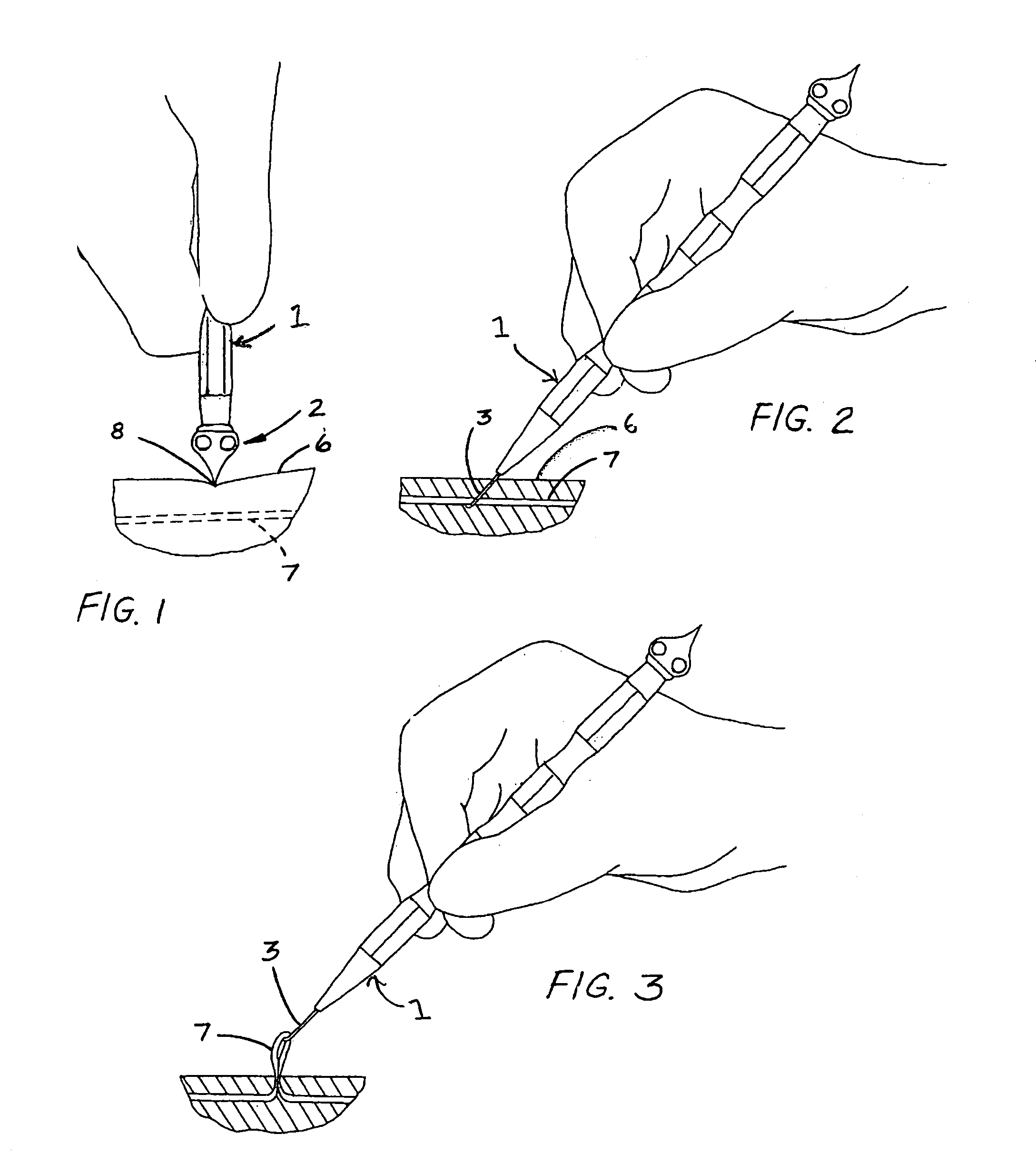 Surgical tool for treating varicose veins