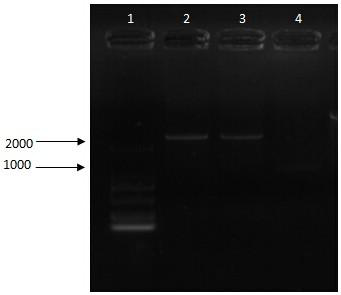 A gene recombination method for high-yielding rhamnolipid in Pseudomonas aeruginosa