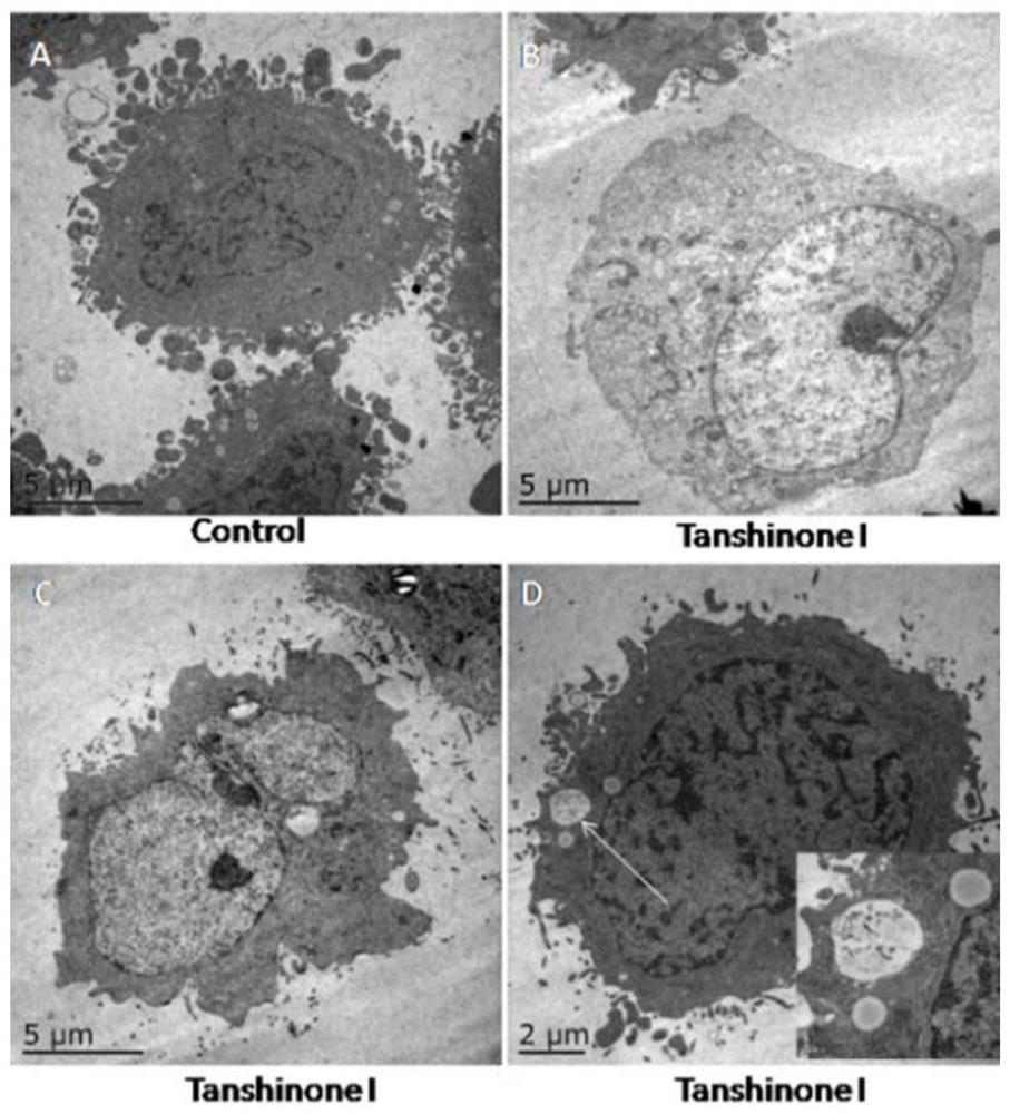 Application of tanshinone i in the preparation of tumor cell autophagy inducer medicine