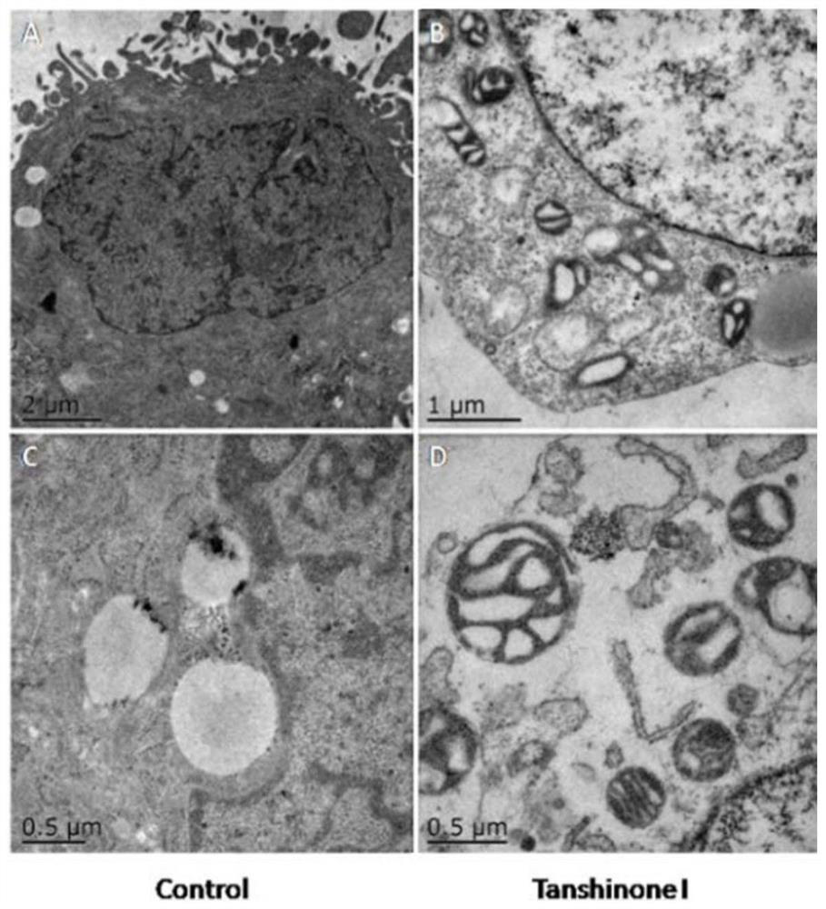 Application of tanshinone i in the preparation of tumor cell autophagy inducer medicine