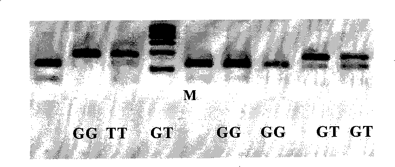 Method for predicting hypertension secondary ventricular hypertrophy and detection reagent kit therefor