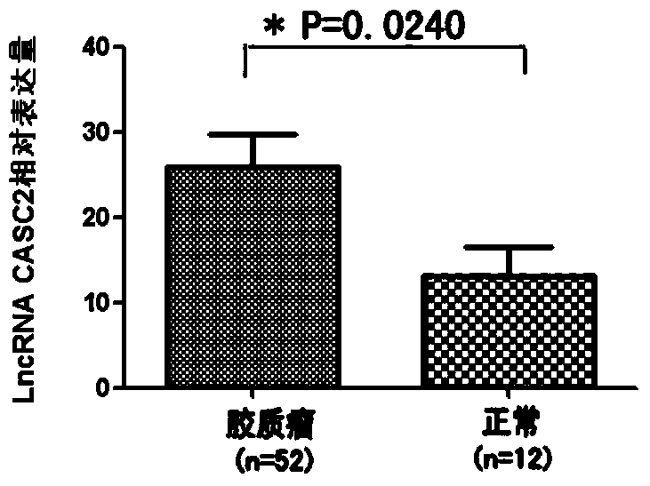 Application method of long non-coding RNA (ribonucleic acid) CASC2 originated from serum exosomes