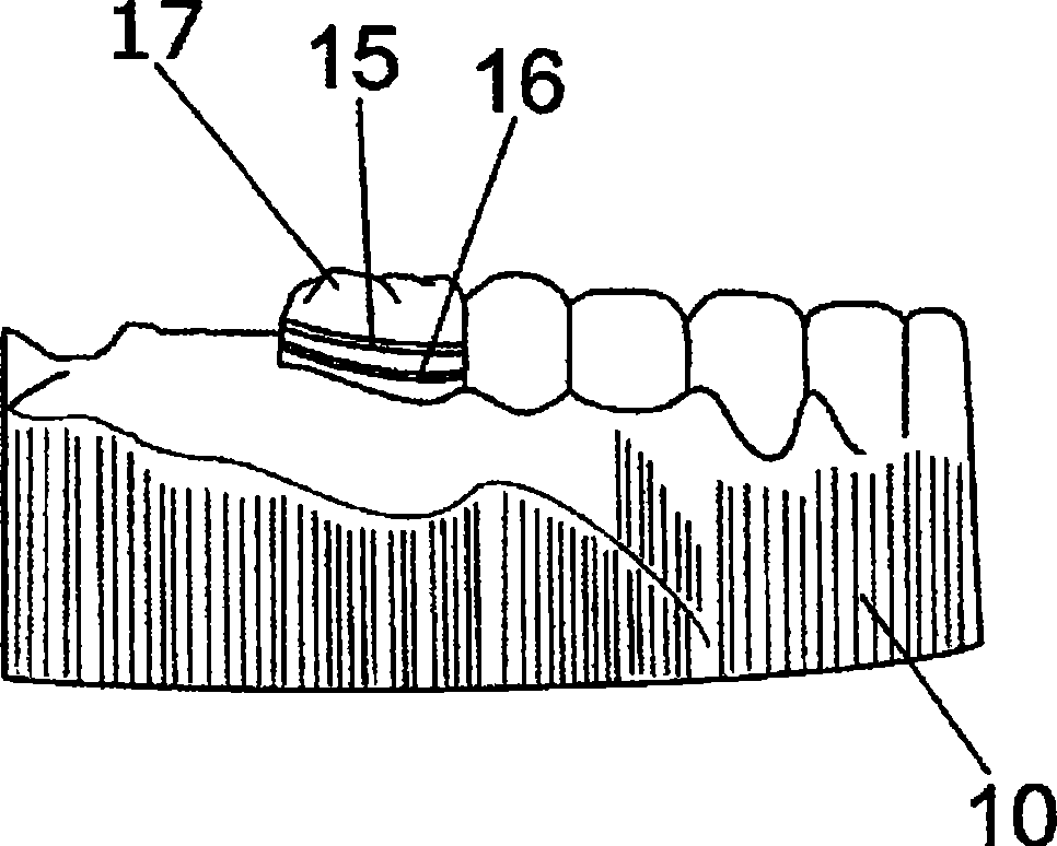 Method for manufacturing digitally-designed removable dental prostheses and system required for this purpose