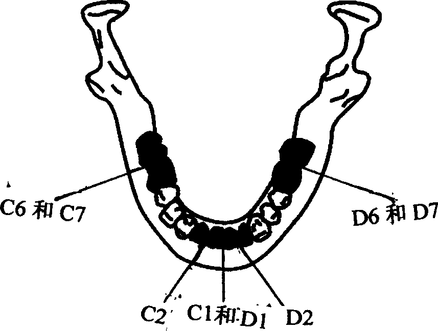 Biomechanical model of human lower jawbone