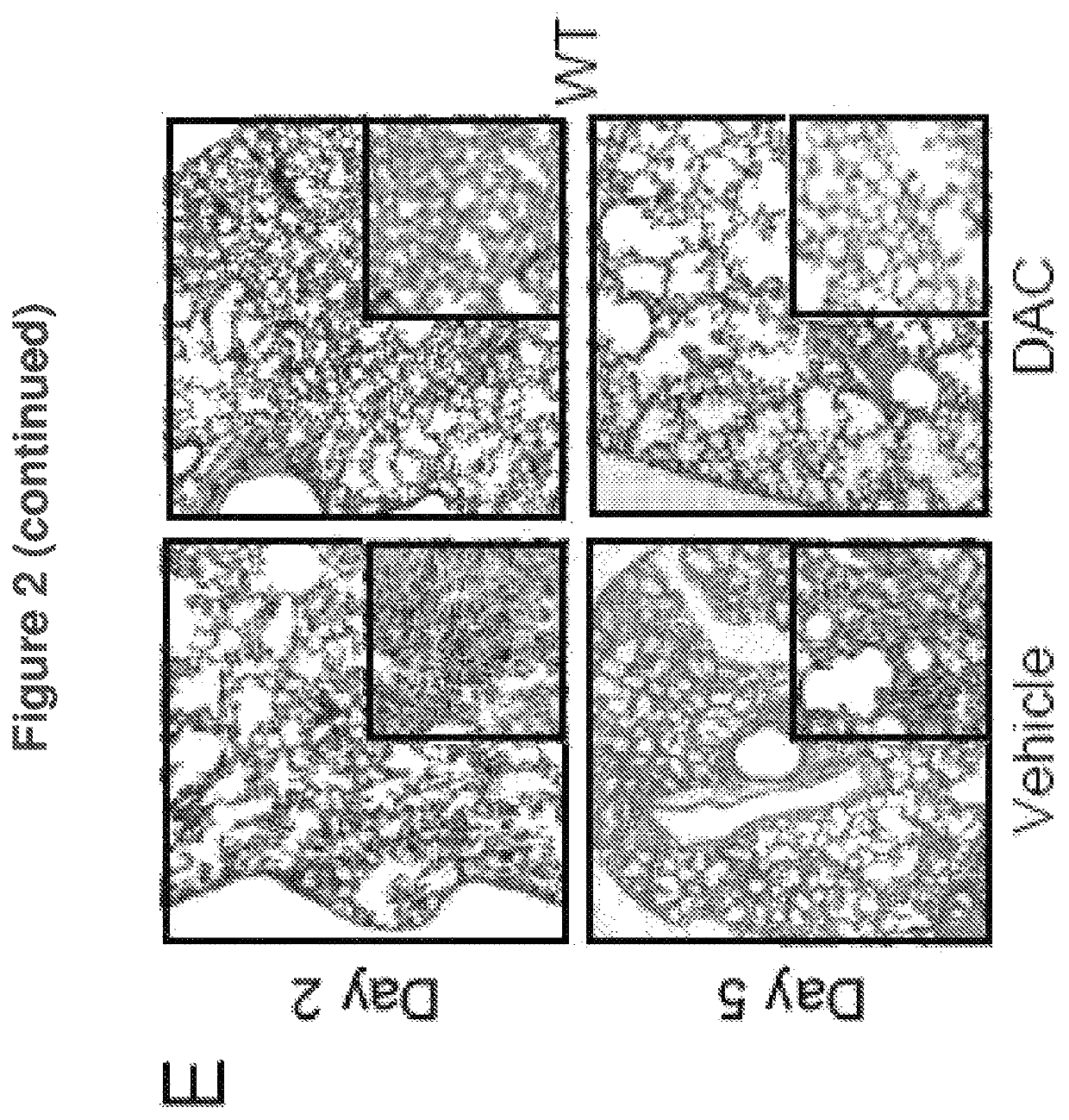 Compositions and methods to accelerate resolution of acute lung inflammation