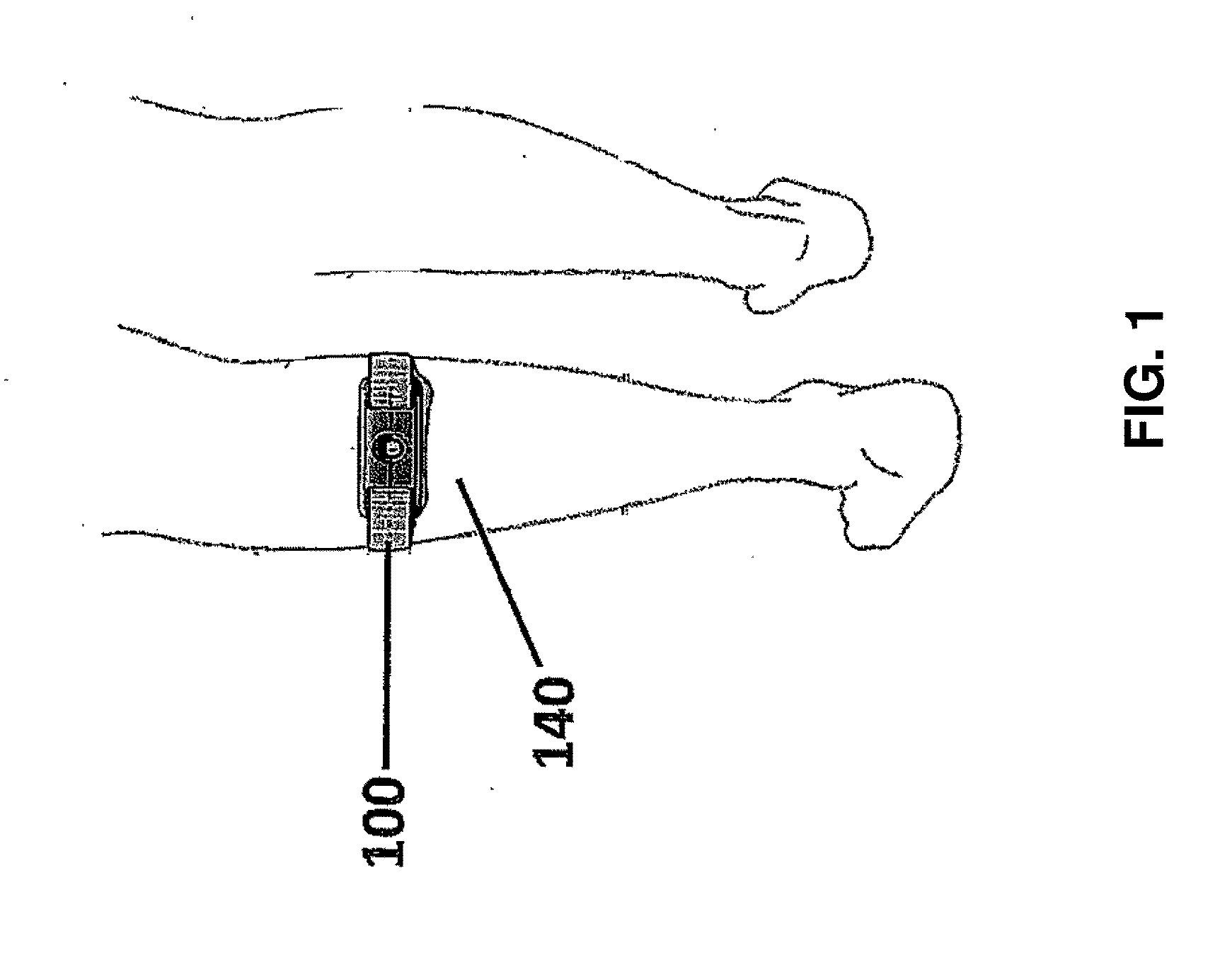 Measuring the "on-skin" time of a transcutaneous electrical nerve stimulator (TENS) device in order to minimize skin irritation due to excessive uninterrupted wearing of the same