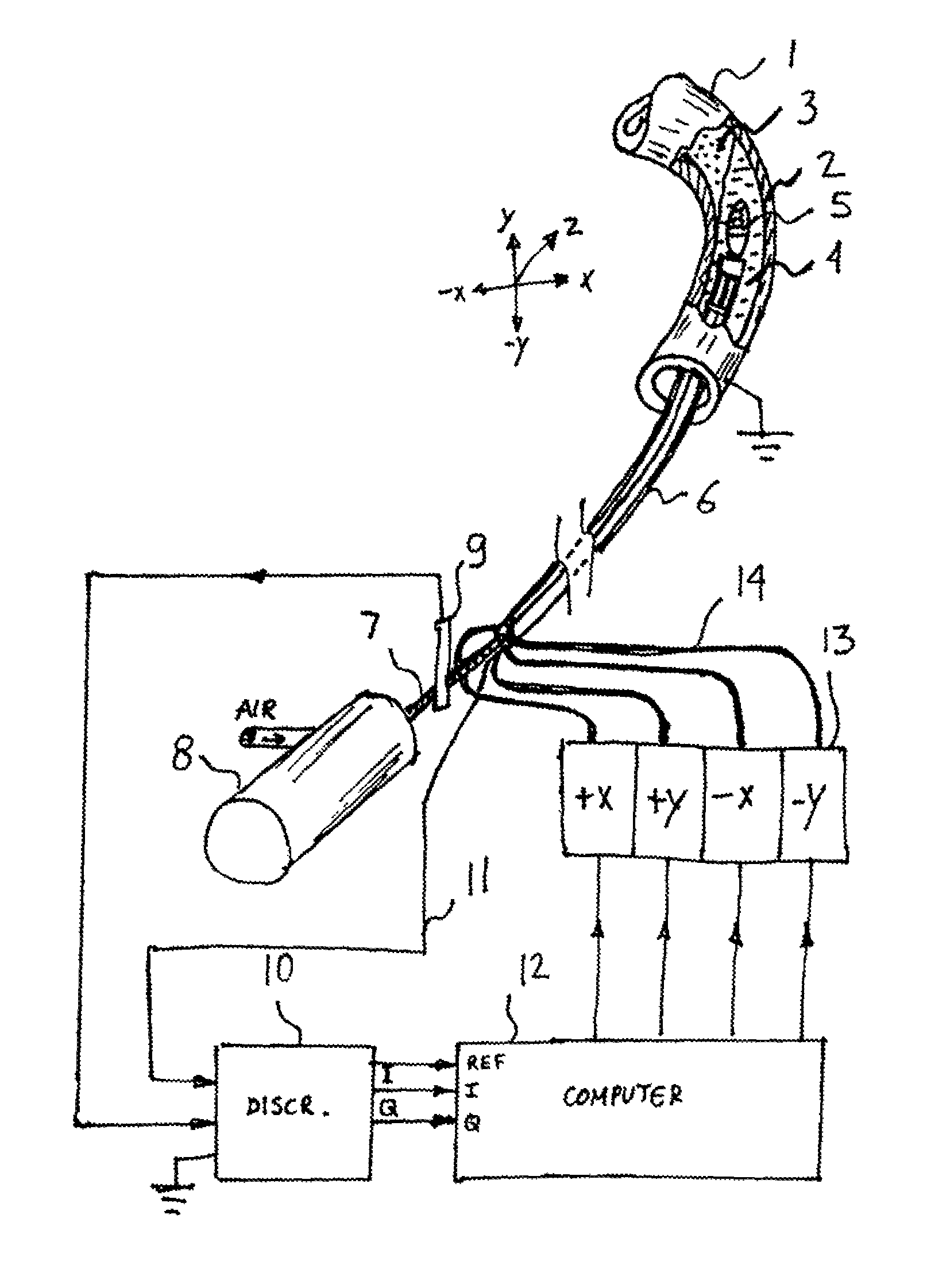 Automatic atherectomy system